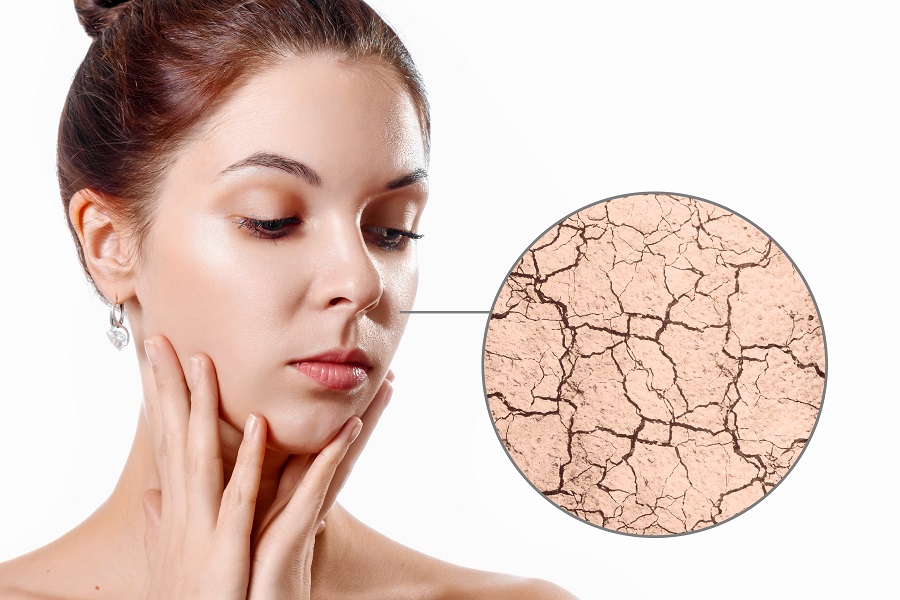 Dry skin causes