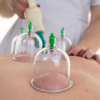 Cupping, an alternative medicine for pain and blemishes