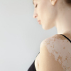 Causes of white spots on the skin